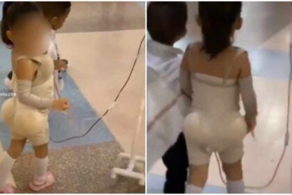 Disfrazaron a una niña de paciente recién salida de una cirugía estética y escadalizó a todos en redes +VIDEO