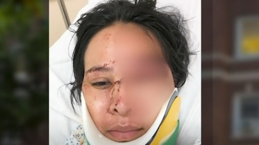 Por un insólito motivo le cayeron a martillazo a una trabajadora mexicana en Nueva York (EEUU), una agresión que ameritó