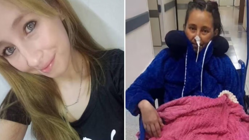 Asistió al hospital a una simple cirugía, pero terminó con una pierna amputada y un trasplante de corazón