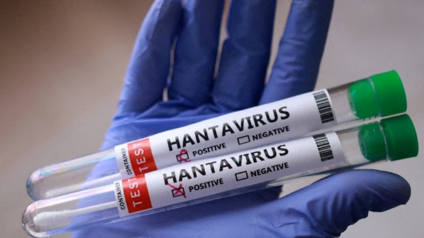 Un residente del condado de Douglas, en Colorado (EEUU), murió tras contraer hantavirus, en un caso que encendió alertas sanitarias y activó una investigación oficial, aunque sin vínculo con el reciente brote del crucero MV Hondius. 