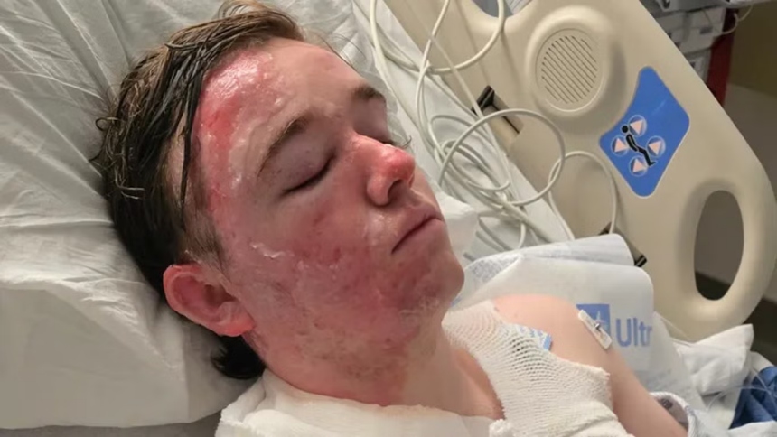 Un gerente de un restaurante de McDonald's en California permanece en estado crítico tras sufrir quemaduras de segundo grado luego de que, presuntamente, una compañera de trabajo le arrojara aceite caliente dentro del local en Yuba City, en un violento episodio que generó conmoción en Estados Unidos.